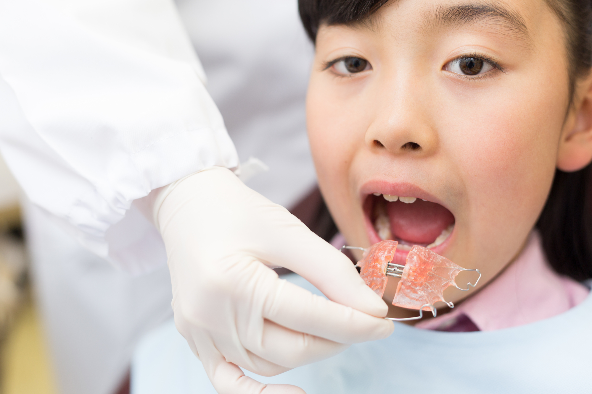子どもが取り外し式の矯正装置を装着している様子